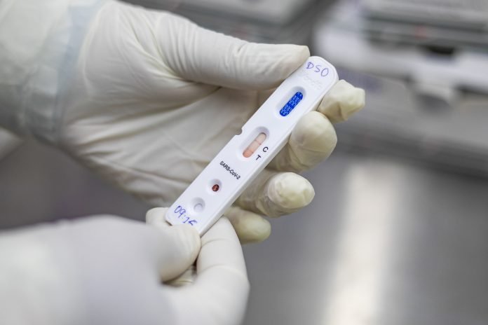 TESTE RAPIDO PARA DETECCAO DE ANTICORPOS CONTRA SARS-CoV-2
